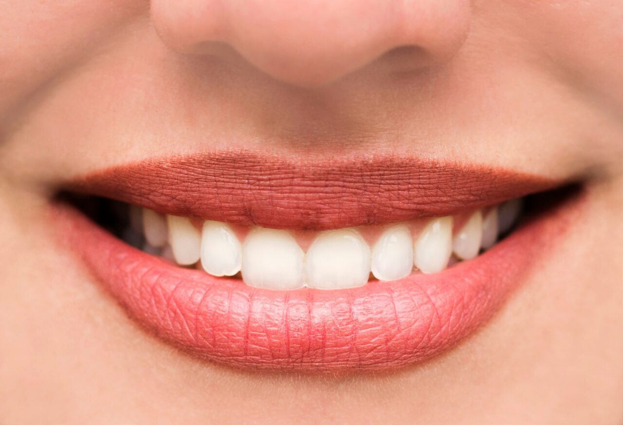Patient smile after cosmetic dental treatment with aligned white teeth